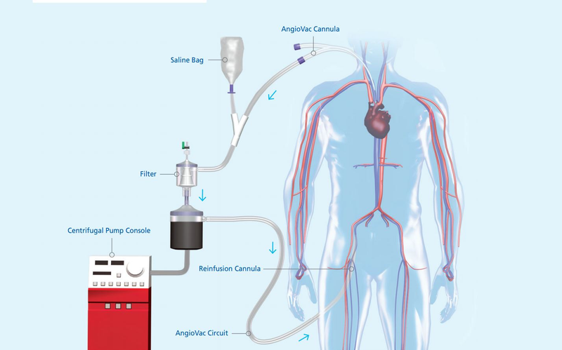 Illustration for article titled This Vampiric Vacuum Vants to Suck Your Blood (and Save Your Life)